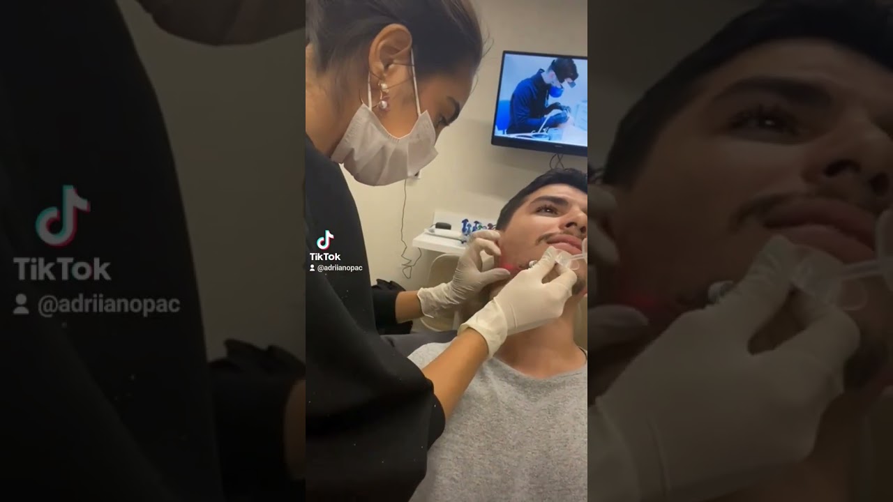 O dia que eu fiz Harmonização Facial.