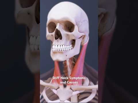Stiff Neck Symptoms and Causes