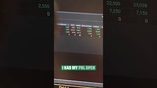 Why P&L Watching Kills Your Profits — Full Breakdown & Transcript