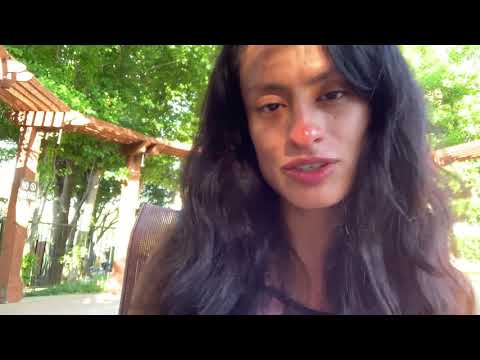 My skin sucks, it’s so ugly.