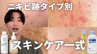9割勘違い。ニキビ跡タイプ別にスキンケア組むならコレ！！