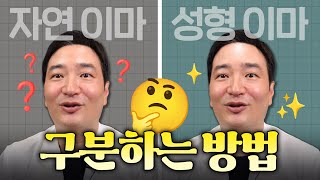 자연 이마, 성형 이마 구분하는 방법? 