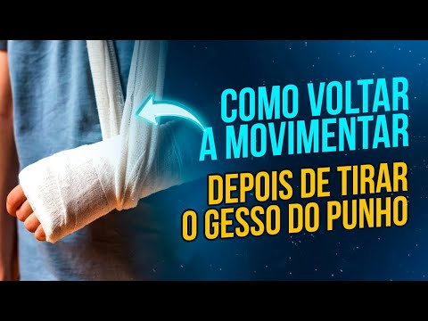 COMO RECUPERAR OS MOVIMENTOS DEPOIS DE UMA FRATURA DO RÁDIO DISTAL E PUNHO?