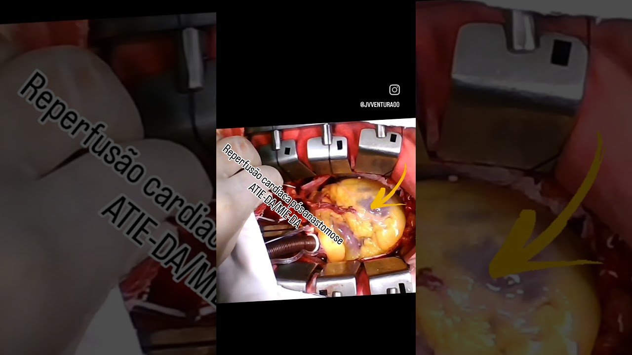 João Victor Ventura De Oliveira-5