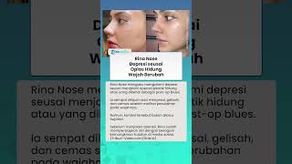 Penampilan Rina Nose Makin Manglingi, Akui Sempat Alami Depresi Post-Op Blues usai Oplas Hidung