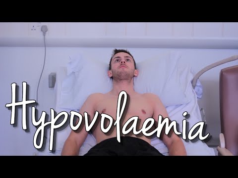 Hypovolaemia (Hyponatraemia)