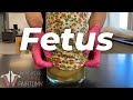 The Human Fetus That Taught Millions - Institute of Human Anatomy The Human Fetus That Taught Millions