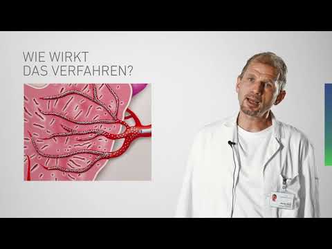 Prostataembolisation in der Radiologie