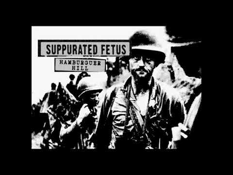 Khe Sanh (Suppurated Fetus) - Demo 2020