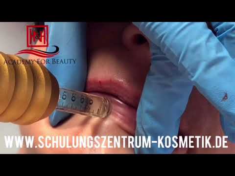 Kapuze der Halswirbelsäule bei einem Kind Was zu tun ist von den monatlichen schmerzte zu vermeiden zurück