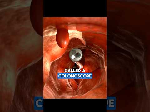 Colonoscopy | Dr. Paulien Moyaert