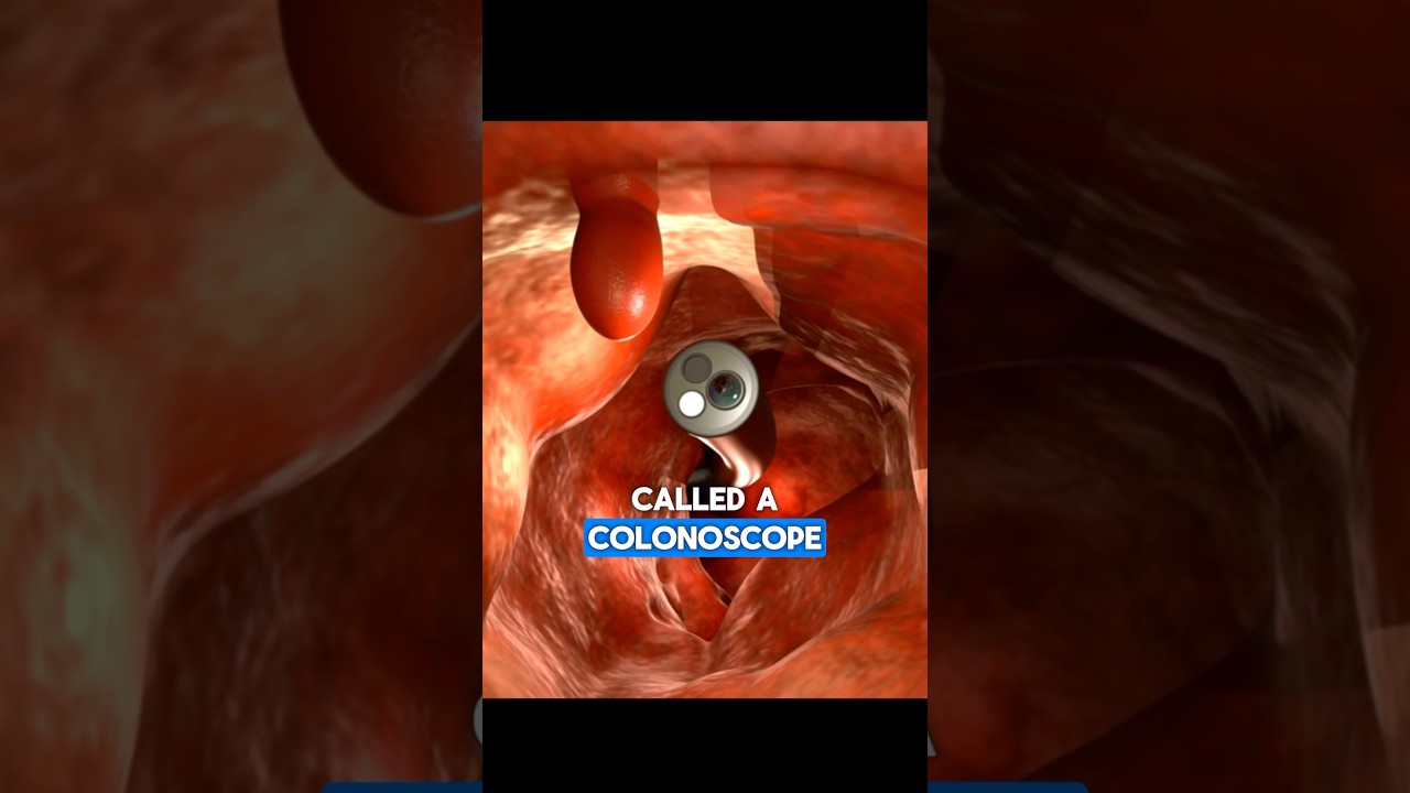 Colonoscopy | Dr. Paulien Moyaert