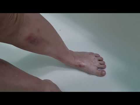 КОГДА ТЕБЕ ХОЧЕТСЯ ВСЕХ УБИТЬ,СРАНЬ ПИШЕТ:САМО, МИКРОБЫ, ИНФЕКЦИЯ, БЕРЕМЕННОСТЬ, ЭМБРИОН ВСЕ СДЕЛАЛ