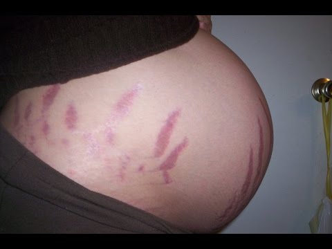 Суставы хрустят с болями Причина боли в шее отдающая в голову