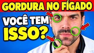 TODOS com GORDURA NO FÍGADO Têm ISSO em Comum! (90% Não Percebem Este Sinal Oculto)