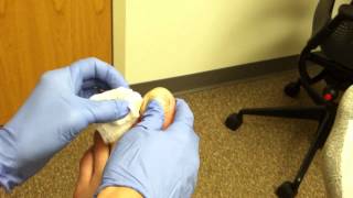 Pus Squeezed From Infected Toe