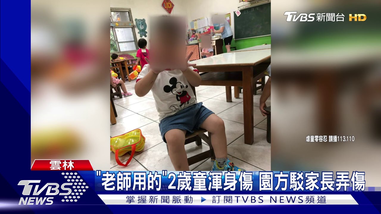 「老師用的」2歲童渾身傷 園方駁家長弄傷