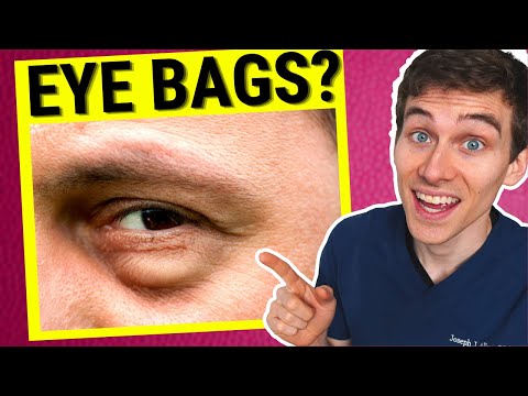 Eye Doctor Explains How to Get Rid of Under EYE BAGS Video