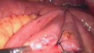 Gastroenterology Surgery