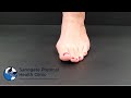 Toe Spreading Squeezing