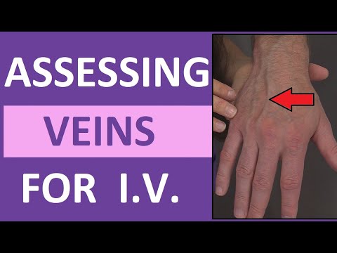 Assessing Veins When Starting an IV Catheter | Finding Veins & Tourniquet Nursing Skill