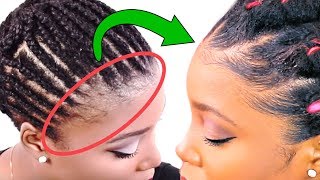 How To Grow Your Edges Back? BEFORE & AFTER Results!