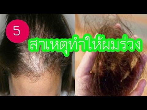 สัญญาณของความอ่อนแอในผู้ชาย 30 ปี สิ่งที่อายุความอ่อนแอและสิ่งที่