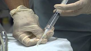 More Men Facing HPV Throat Cancer