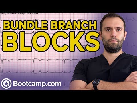 Conduction Blocks - Bundle Branch Blocks | HIGH-YIELD CARDIOLOGY | USMLE STEP 1