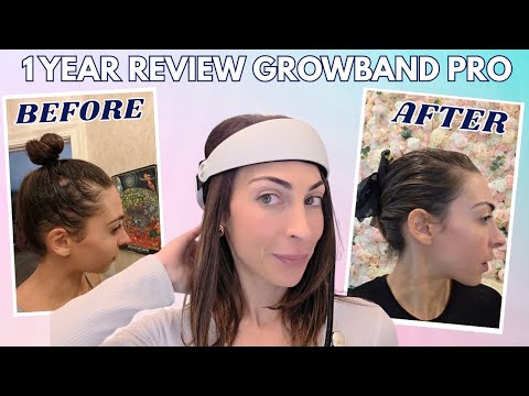Growband hair loss testimonial video thumbnail