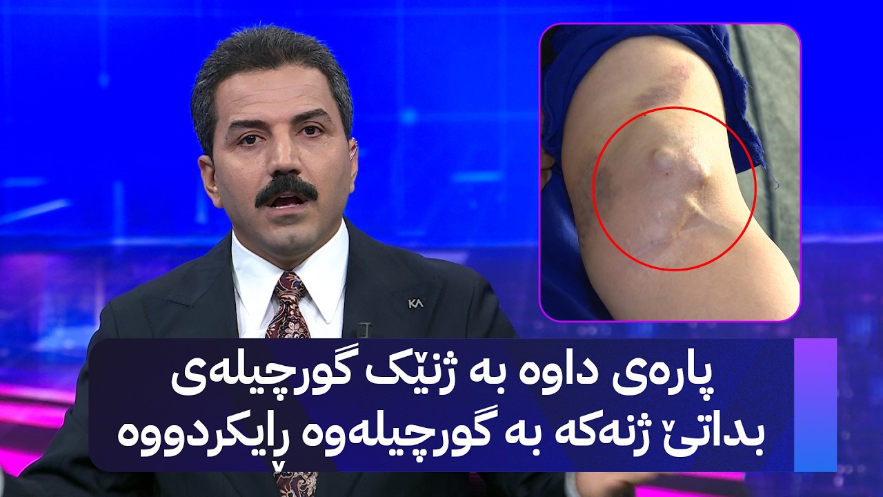 ڤیدیۆ | پارەی داوە بە ژنێک گورچیلەی بداتێ ژنەکە بە گورچیلەوە ڕایکردووە