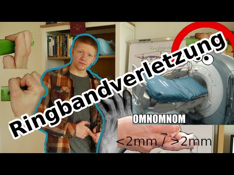 Was tun bei Ringbandverletzung? | Physiotherapie für Kletterer | Fingerverletzung | Fingerschmerzen