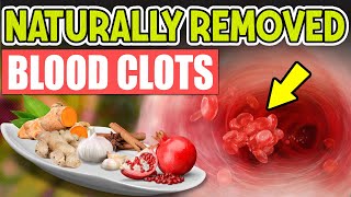 Top 10 Best Foods That Naturally Thin the Blood to Prevent Clots🍏🌶️🍵