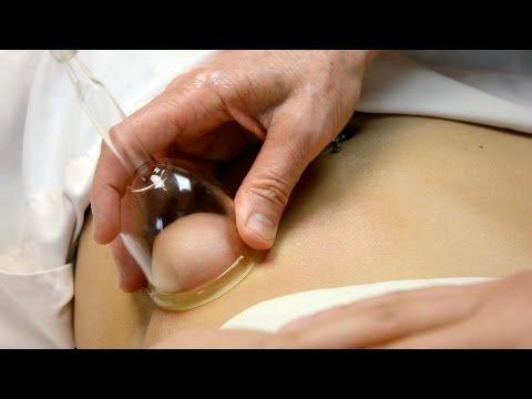 Pagkain sa proseso ng pagkawala ng timbang Mangga slimming