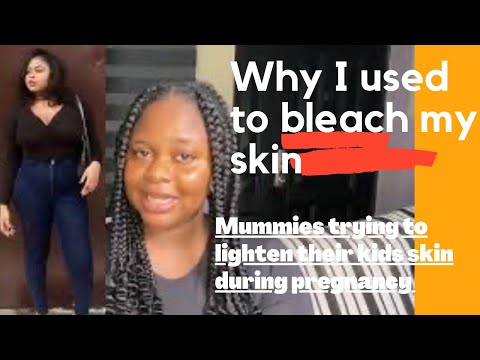 Talk with Sonia-Skin lightening- why I decided to bleach my skin in the past