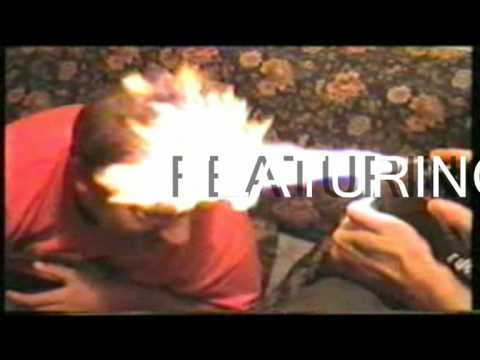 the scabs suck my d.v.d preview