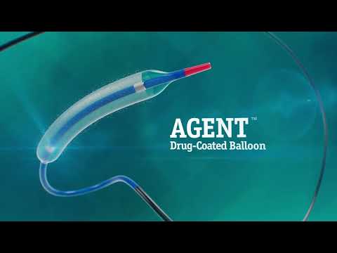 AGENT™ Drug-Coated Balloon: Proven treatment for coronary in-stent restenosis (ISR)