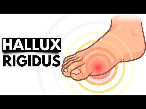 All About Allergy Shots