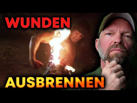 Wunde ausbrennen - sinnvolle Erste Hilfe oder nur gut im Actionfilm?
