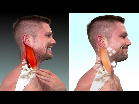 This Will Fix Your Tight Neck Way More Than Stretching