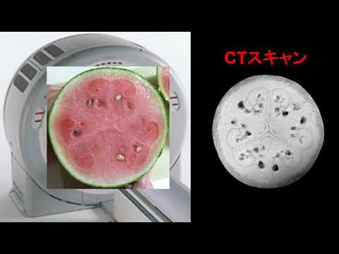 【医学部保健学科】X線CTスキャンの紹介
