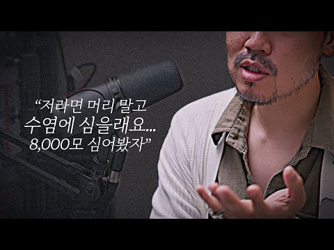 모발이식할 바엔 수염에 심고 삭발하겠다는 남자의 이야기