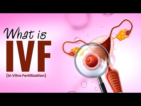What is IVF (In Vitro Fertilization) in Pregnancy?