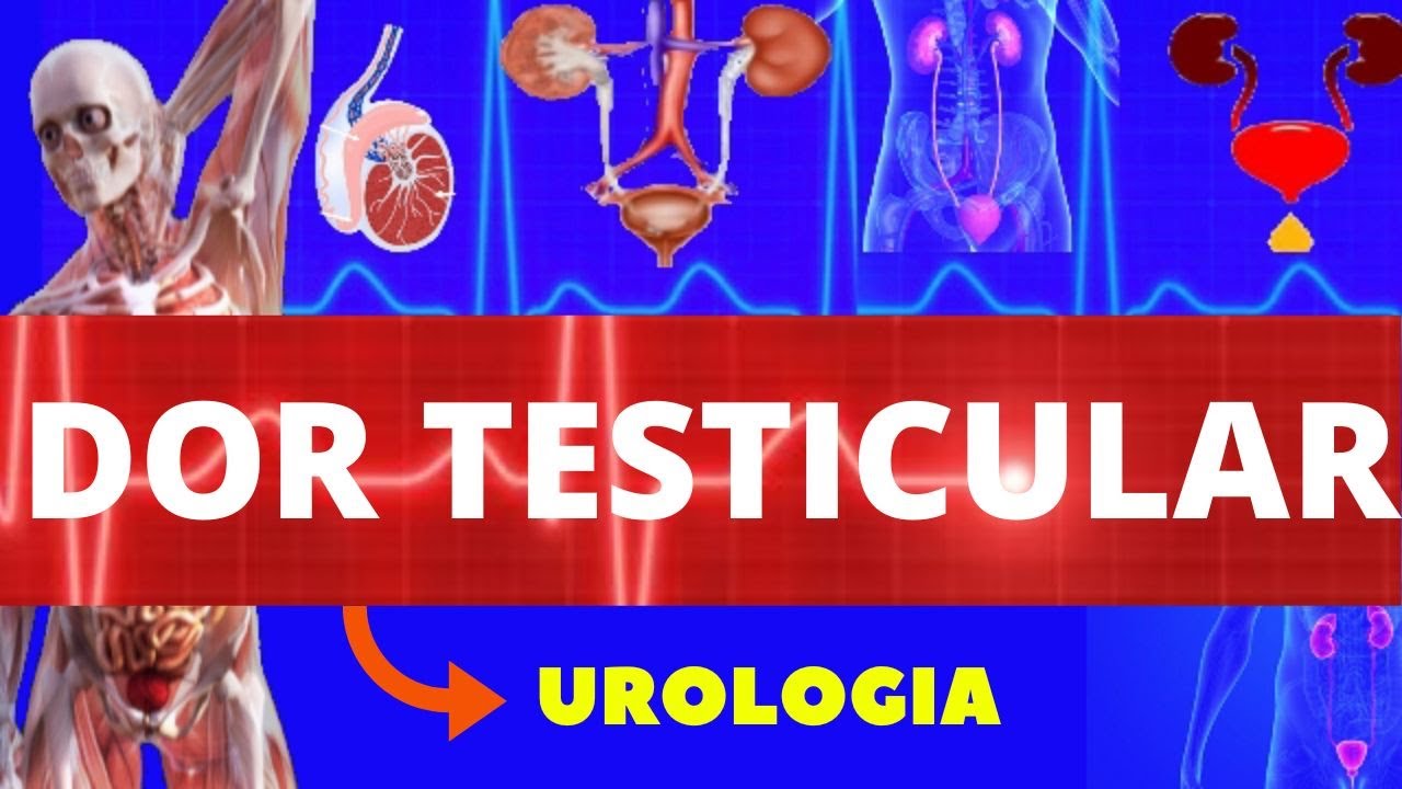 DOR TESTICULAR (EPIDIDIMITE E TORÇÃO TESTICULAR) - CAUSAS, SINTOMAS E TRATAMENTO - UROLOGIA