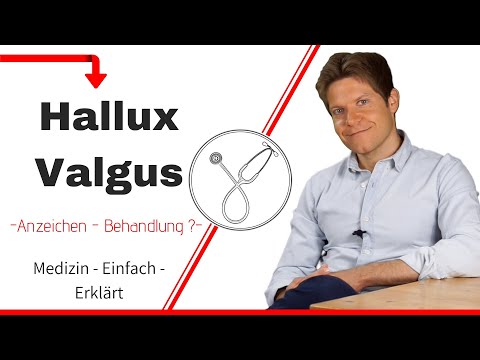 Was ist ein Hallux Valgus? Wie behandelt man diese Erkrankung?
