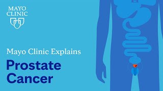 Mayo Clinic Explains Prostate Cancer