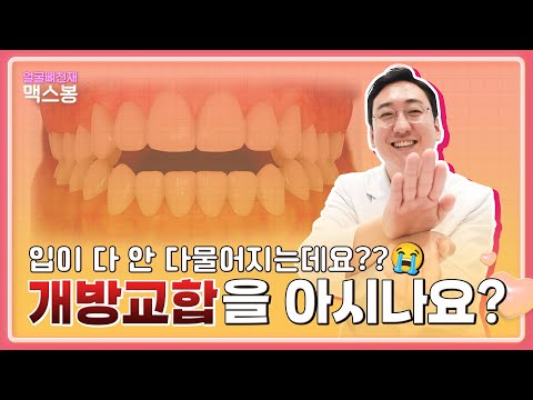 개방교합에 대한 모든것, 이 영상 하나로 끝!