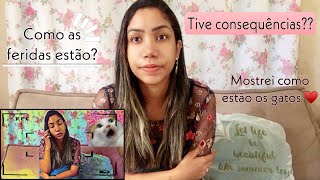 MINHA VIDA DEPOIS DA ESPOROTRICOSE + MEDICAMENTOS QUE USEI - Esporotricose em humanos