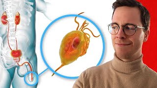 Trichomoniasis (Trich): The Genital Parasite