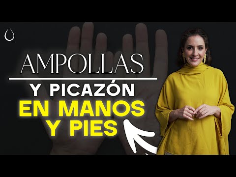 🔴 No es HONGOS es DISHIDROSIS @drapilarochoa - Dermatologa